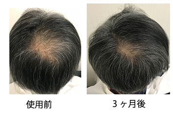 使用前 3ヶ月後